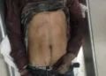 अनूप बंसल की फैक्ट्री बनी मजदूरों की कब्रगाह, मजदूर ऊँचाई से गिर कर मरा